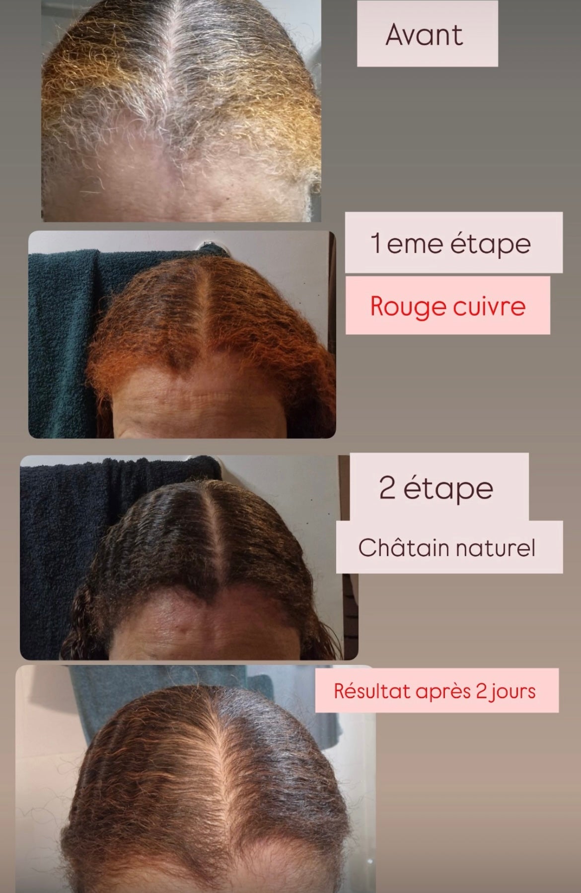 PACK 1 - Produit cosmétique - 3 PRODUITS